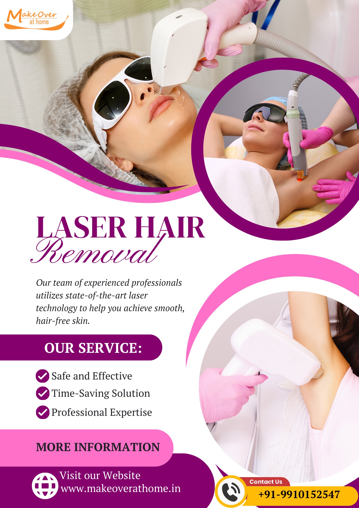 leser hair removal